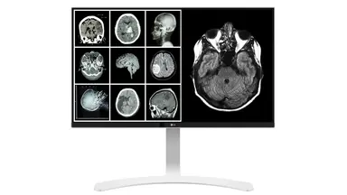 27INCH LG Medical Ips 8MP UHD 4K Clinical Monitor 3840X2160 HDMI DP USB Pivot